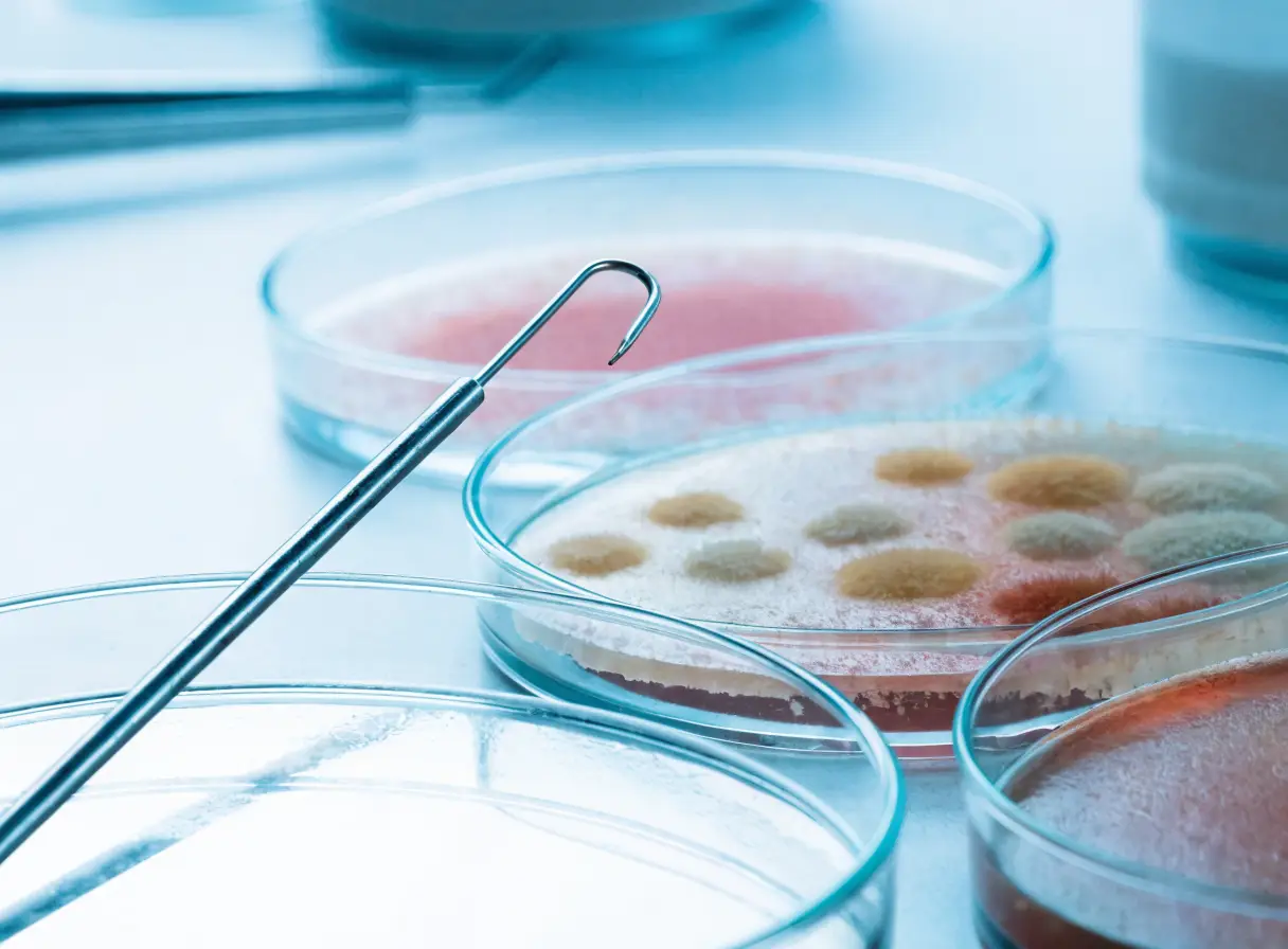Microbiology petri dishes with culture media